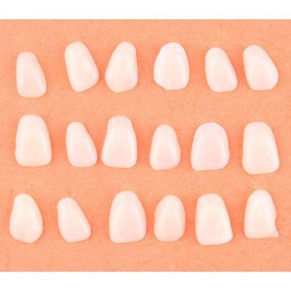 Thin Teeth Temporary Veneers Anterior Resin Mixed Beige